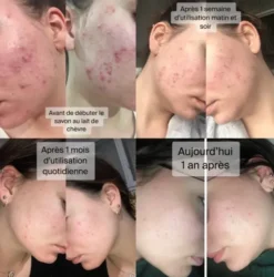 Soins Visage Bio Anti Boutons Peaux Mixtes à Grasses Parfum Thé