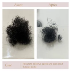 Gummies Vegan Et Naturel Croissance Naturelle Des Cheveux -Boutique Ipheos b9cf34b542601e78cf619eeb80d25121 2